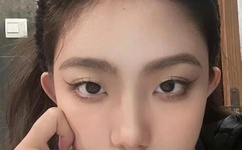 天天视频ios下载安装